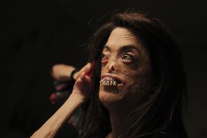 Fide, una mujer que sufre una enfermedad rara Fide, una mujer que sufre una enfermedad rara
