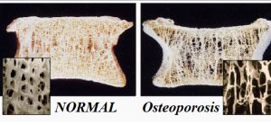 Orthopoedicson Orthopoedicson