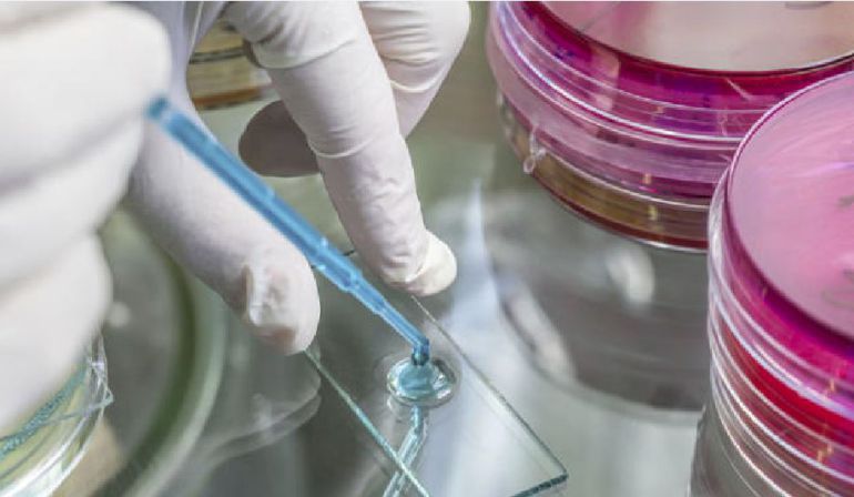 Legionella en Alcàsser y Silla: Detectados diez casos de legionella en Alcàsser y Silla Legionella en Alcàsser y Silla: Detectados diez casos de legionella en Alcàsser y Silla