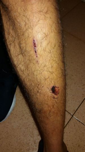 CIE Aluche: Uno de los internos del CIE de Aluche: "Nos pegaron, nos cachearon, nos pisaron el Corán, que es nuestra religión" CIE Aluche: Uno de los internos del CIE de Aluche: "Nos pegaron, nos cachearon, nos pisaron el Corán, que es nuestra religión"