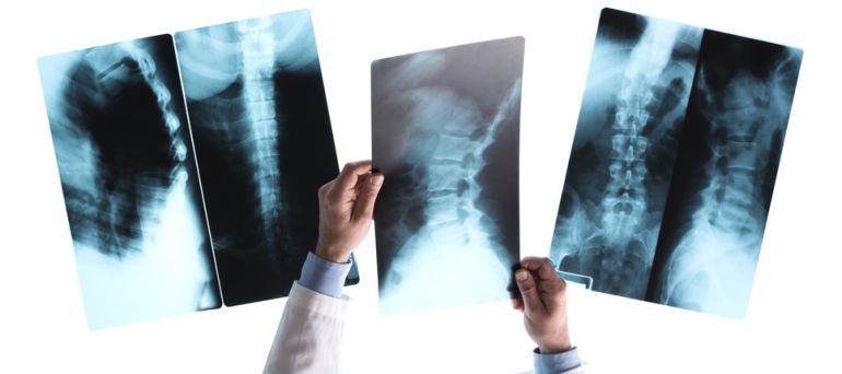 Recuperan el 77% de los estudios radiológicos perdidos en Ávila Recuperan el 77% de los estudios radiológicos perdidos en Ávila