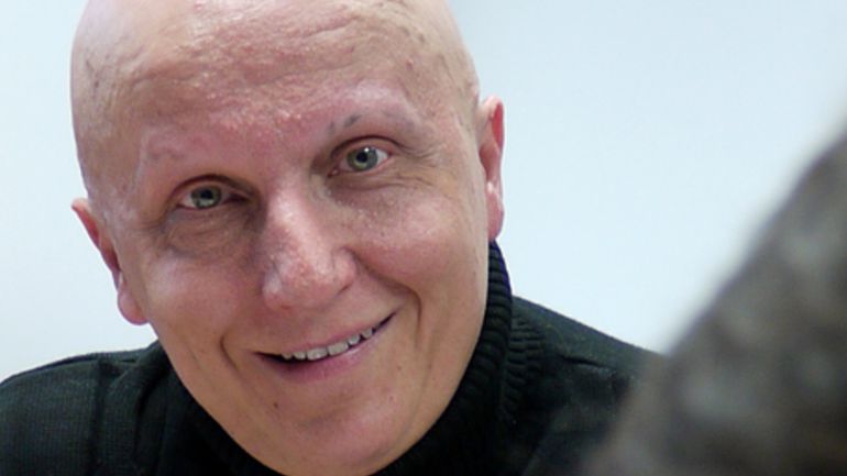Paco Sanz en una imatge promocional del seu web on demana ajuda per tractar-se la síndrome de Cowden. Paco Sanz en una imatge promocional del seu web on demana ajuda per tractar-se la síndrome de Cowden.