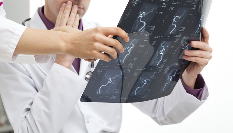 Cáncer: Bilbao, referente de la radiología oncológica Cáncer: Bilbao, referente de la radiología oncológica