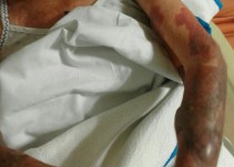 Felisa: “Mi madre sufre las consecuencias de la falta de personal en Moscatelares”