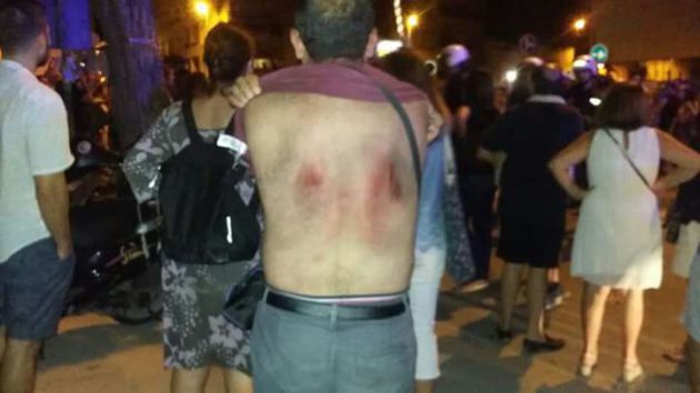 Graves incidentes, heridos y detenciones en la tercera concentración Pro-Soterramiento Graves incidentes, heridos y detenciones en la tercera concentración Pro-Soterramiento