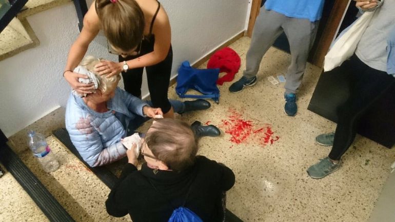 Una de las personas heridas por la actuación policial de ayer en Barcelona Una de las personas heridas por la actuación policial de ayer en Barcelona