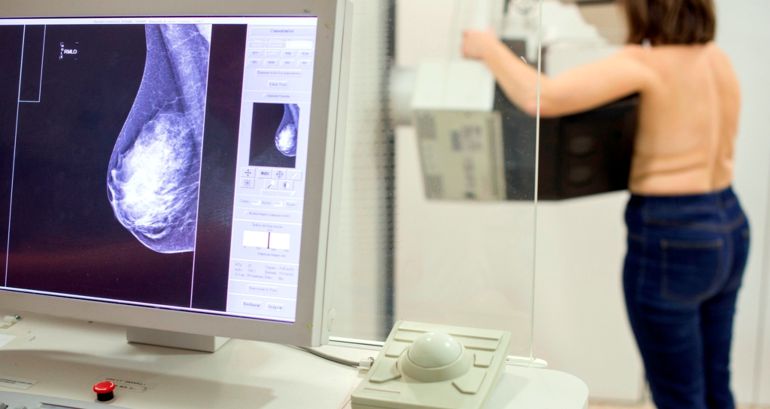 Una dona es fa una mamografia per detectar si té càncer de mama Una dona es fa una mamografia per detectar si té càncer de mama