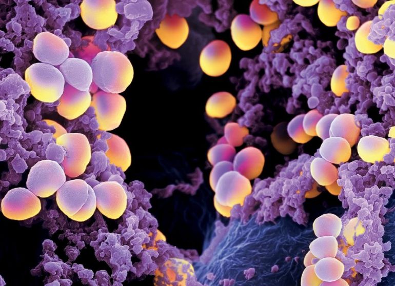 Bacterias Bacterias