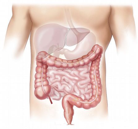 La mitad de los mayores de 60 años padece Diverticulosis La mitad de los mayores de 60 años padece Diverticulosis