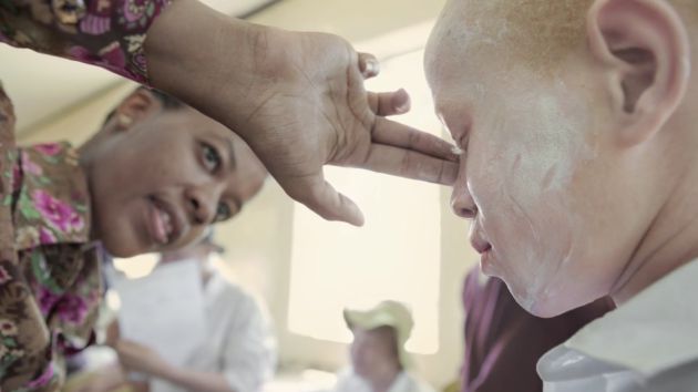 Ser albino en Tanzania, en imágenes