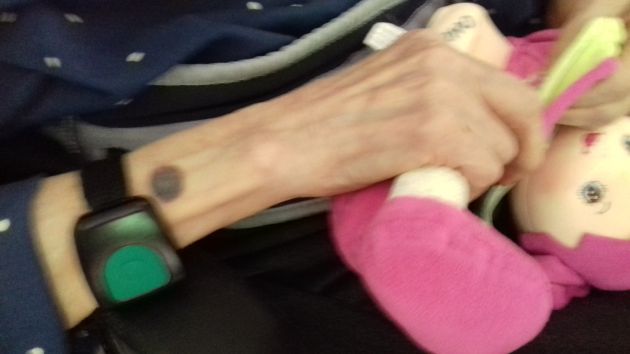 Hematoma en el antebrazo de una de las residentes malatratadas en Los Nogales. Hematoma en el antebrazo de una de las residentes malatratadas en Los Nogales.