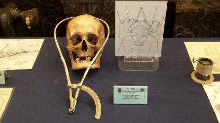 El método de Bertillón, precursor de la identificación antropométrica (finales del siglo XIX) El método de Bertillón, precursor de la identificación antropométrica (finales del siglo XIX)