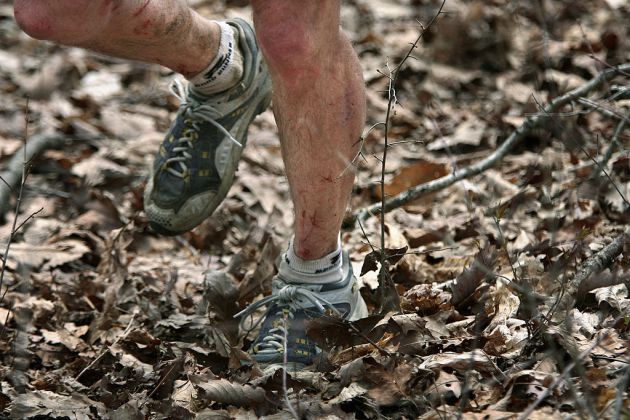 Las piernas del corredor Jim Nelson, en la Barkley de 2017, magulladas y arañadas por las espinas de los arbustos que se encontró en la competición Las piernas del corredor Jim Nelson, en la Barkley de 2017, magulladas y arañadas por las espinas de los arbustos que se encontró en la competición