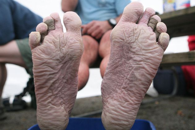 Los pies de Mike Dobies tras la tercera vuelta en la Barkley de 2017 Los pies de Mike Dobies tras la tercera vuelta en la Barkley de 2017
