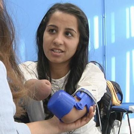 María con la prótesis María con la prótesis