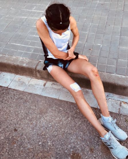 Celia Antón compartió en su cuenta de Instagram una imagen donde se podían comprobar las quemaduras producidas tras la caída en la pista. Celia Antón compartió en su cuenta de Instagram una imagen donde se podían comprobar las quemaduras producidas tras la caída en la pista.