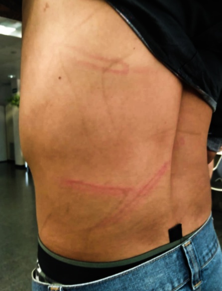 Uno de los chicos agredido por tres porteros de discoteca: "A mi amigo podían haberle roto el cuello" Uno de los chicos agredido por tres porteros de discoteca: "A mi amigo podían haberle roto el cuello"