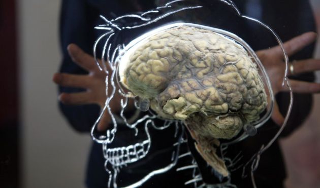 La importancia de conocer los primeros síntomas del ictus y de cómo actuar La importancia de conocer los primeros síntomas del ictus y de cómo actuar