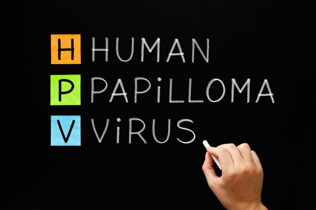 El virus del papiloma humano aumenta la incidencia del cáncer de ano El virus del papiloma humano aumenta la incidencia del cáncer de ano
