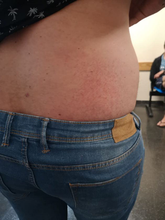 Algunas de las heridas denunciadas. Algunas de las heridas denunciadas.