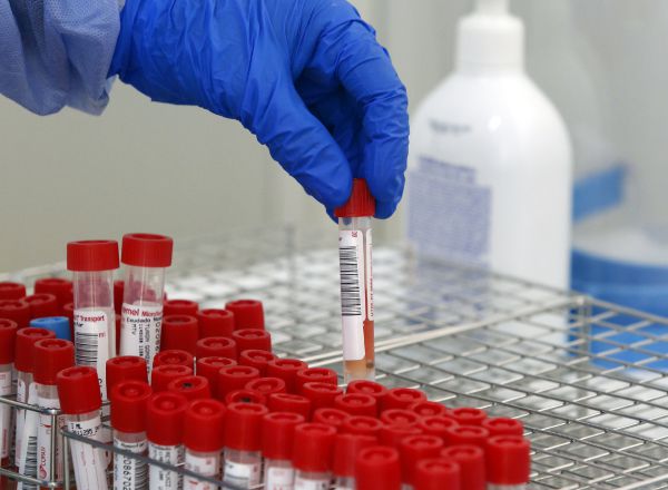 Este jueves el Departamento de Salud ha notificado 632 casos de COVID-19 detectados en las últimas 24 horas