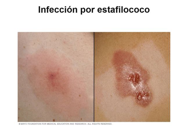 Consecuencias mal uso mascarillas Consecuencias mal uso mascarillas