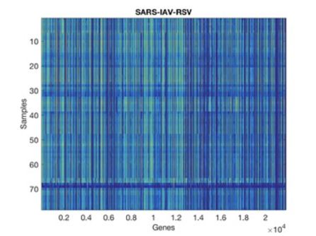 Nivel de expresión de diferentes genes en muestras infectadas por COVID, gripe A y RSV, de acuerdo a los datos del Hospital Monte Sinaí. Nivel de expresión de diferentes genes en muestras infectadas por COVID, gripe A y RSV, de acuerdo a los datos del Hospital Monte Sinaí.