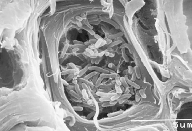 Fotografía de Xylella fastidiosa al microscopio electrónico de barrido. La barra blanca de escala corresponde a 5 micras (1:200 de milímetro) Fotografía de Xylella fastidiosa al microscopio electrónico de barrido. La barra blanca de escala corresponde a 5 micras (1:200 de milímetro)