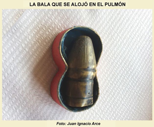 La bala que se alojó en el pulmón La bala que se alojó en el pulmón