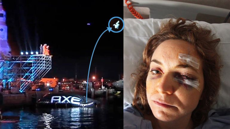Imagen del salto de Yaiza en el Ibiza AXE Space Jump de 2013 y aspecto de la joven en el hospital donde se recuperaba de la lesiones sufridas. Imagen del salto de Yaiza en el Ibiza AXE Space Jump de 2013 y aspecto de la joven en el hospital donde se recuperaba de la lesiones sufridas.