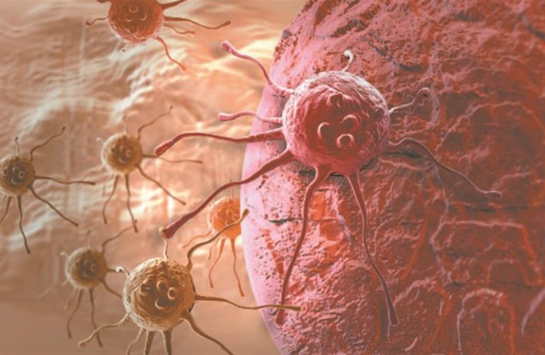 El ensayo clínico de inmunoterapia del cáncer pretende mejorar la calidad de vida de los pacientes El ensayo clínico de inmunoterapia del cáncer pretende mejorar la calidad de vida de los pacientes