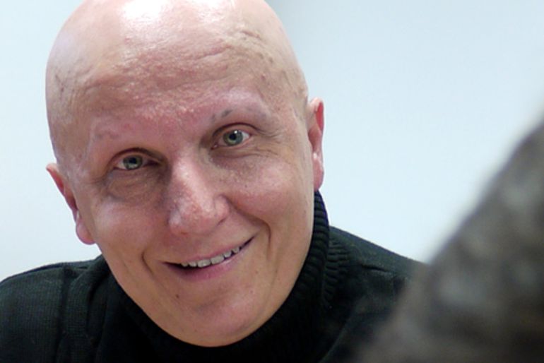 Paco Sanz en una imagen promocional de su web donde demanda ayuda para tratar el Síndrome de Cowden que padece. Paco Sanz en una imagen promocional de su web donde demanda ayuda para tratar el Síndrome de Cowden que padece.