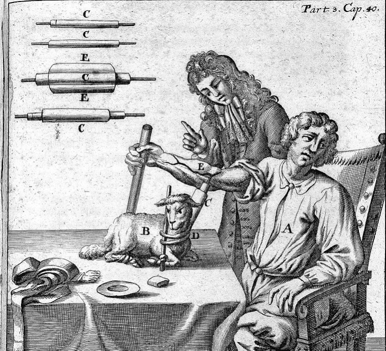 Grabado del doctor Jean Baptiste Denis trasfundiendo sangre de una oveja a un humano Grabado del doctor Jean Baptiste Denis trasfundiendo sangre de una oveja a un humano