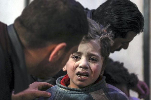 Un niño herido recibe ayuda en un hospital controlado por los rebeldes en Douma (Siria) hoy, lunes 19 de febrero de 2018. Al menos 77 de personas murieron hoy y más de 250 resultaron heridas por ataques aéreos y de artillería contra la región de Guta Oriental, el principal feudo opositor de las afueras de Damasco, en medio de preparativos de una posible ofensiva gubernamental en la zona. Un niño herido recibe ayuda en un hospital controlado por los rebeldes en Douma (Siria) hoy, lunes 19 de febrero de 2018. Al menos 77 de personas murieron hoy y más de 250 resultaron heridas por ataques aéreos y de artillería contra la región de Guta Oriental, el principal feudo opositor de las afueras de Damasco, en medio de preparativos de una posible ofensiva gubernamental en la zona.