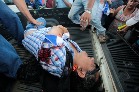 Demonstrators help an injured man during a protest against Nicaraguan President Daniel Ortega's government in Managua Demonstrators help an injured man during a protest against Nicaraguan President Daniel Ortega's government in Managua
