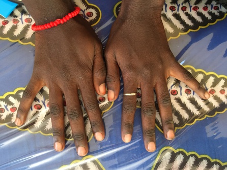 Las manos de “Aminata”( nombre figurado para preservar su privacidad )en el centro El Wafa, donde recibe el apoyo integral para reponerse de la doble violación de la que ha sido víctima Las manos de “Aminata”( nombre figurado para preservar su privacidad )en el centro El Wafa, donde recibe el apoyo integral para reponerse de la doble violación de la que ha sido víctima