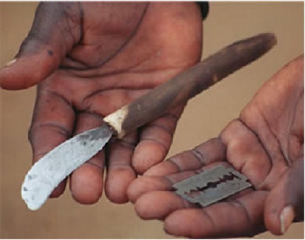 Herramientas usadas para una mutilación genital femenina (FGM) Herramientas usadas para una mutilación genital femenina (FGM)