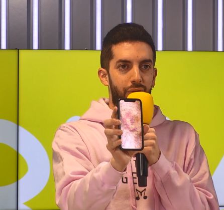 David Broncano enseña su rodilla amoratada. David Broncano enseña su rodilla amoratada.