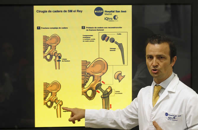 El doctor Ángel Villamor explica los detalles de la fractura de cadera del rey Juan Carlos El doctor Ángel Villamor explica los detalles de la fractura de cadera del rey Juan Carlos