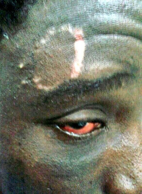 Inmigrante herido por el impacto de pelotas de goma en la playa de Ceuta cuando intentaba entrar a nado, según denuncia la Coordinadora de Barrios a través de esta imagen Inmigrante herido por el impacto de pelotas de goma en la playa de Ceuta cuando intentaba entrar a nado, según denuncia la Coordinadora de Barrios a través de esta imagen