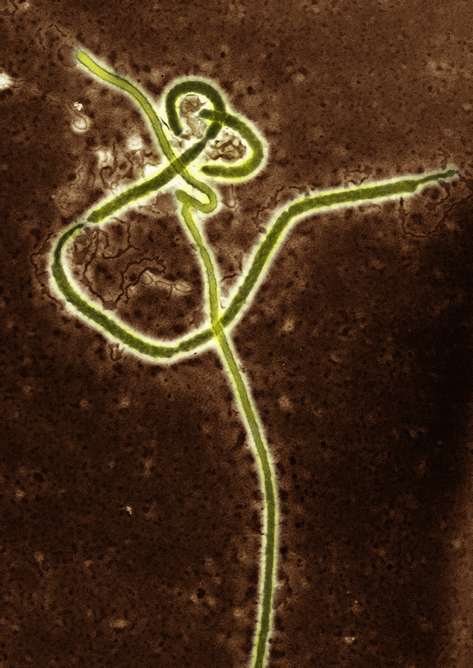 El virus del ébola, vista en el microscopio El virus del ébola, vista en el microscopio