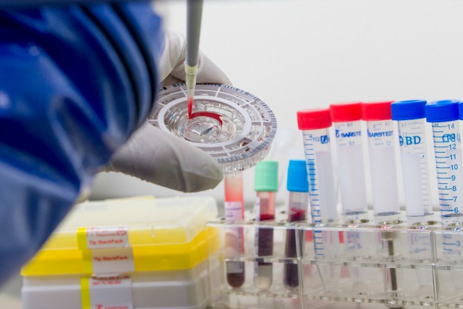 Pruebas del tratamiento experimental para enfermedades contagiosas como el ébola. Pruebas del tratamiento experimental para enfermedades contagiosas como el ébola.