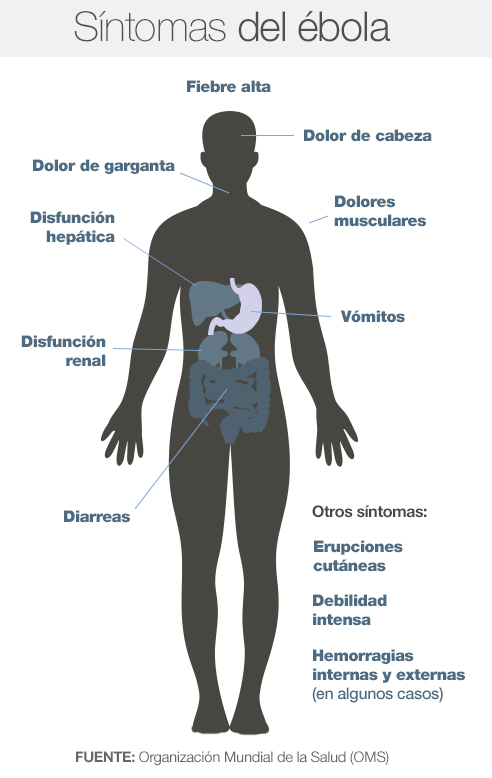 Síntomas del ébola según el OMS. Síntomas del ébola según el OMS.