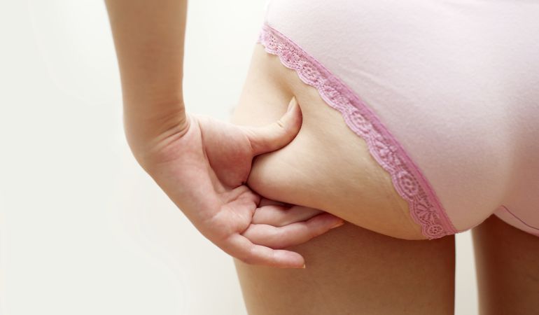 3 alimentos que tienes en casa y que te ayudarán a camuflar la celulitis 3 alimentos que tienes en casa y que te ayudarán a camuflar la celulitis