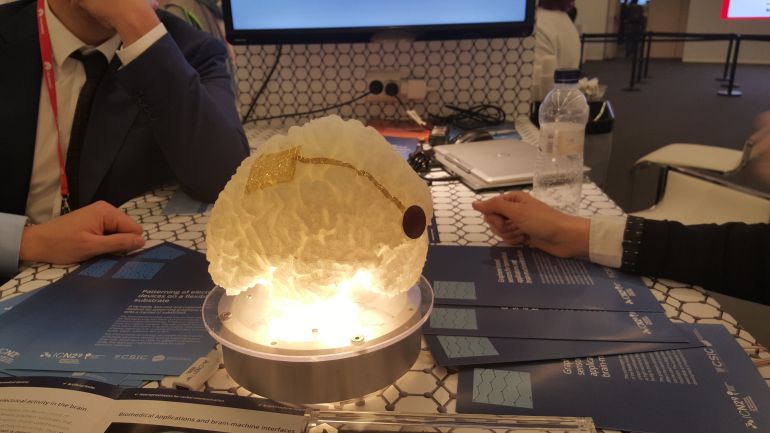 Imagen del sensor de grafeno implantado en una reproducción del cerebro humano Imagen del sensor de grafeno implantado en una reproducción del cerebro humano