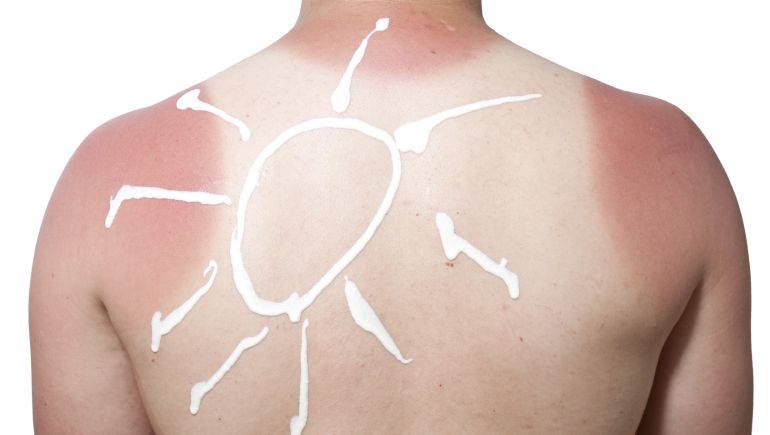 Diez cosas que haces mal al tomar el sol Diez cosas que haces mal al tomar el sol