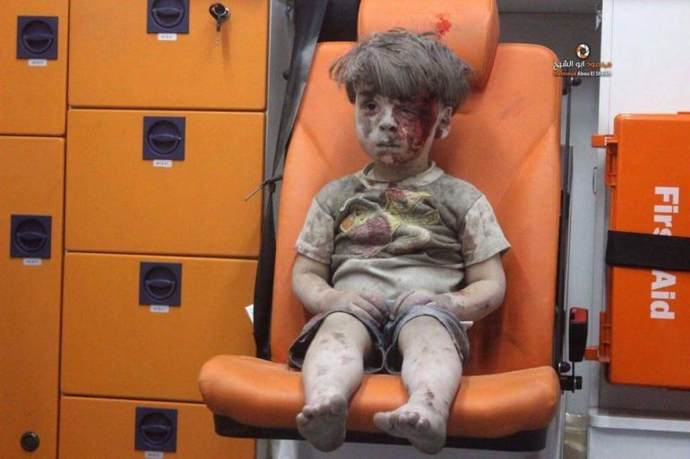 El doctor que atendió a este niño sirio herido quiso que esta foto diera la vuelta al mundo - Imagen 2