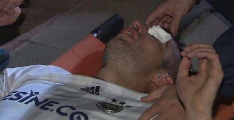 Robin Van Persie, con el ojo cubierto tras el codazo que sufrió Robin Van Persie, con el ojo cubierto tras el codazo que sufrió