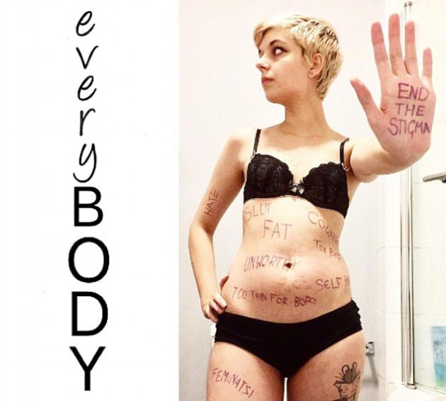 El antes y el después de la anorexia El antes y el después de la anorexia