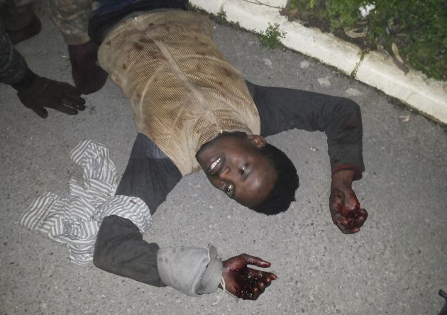 Inmigrante herido. Inmigrante herido.